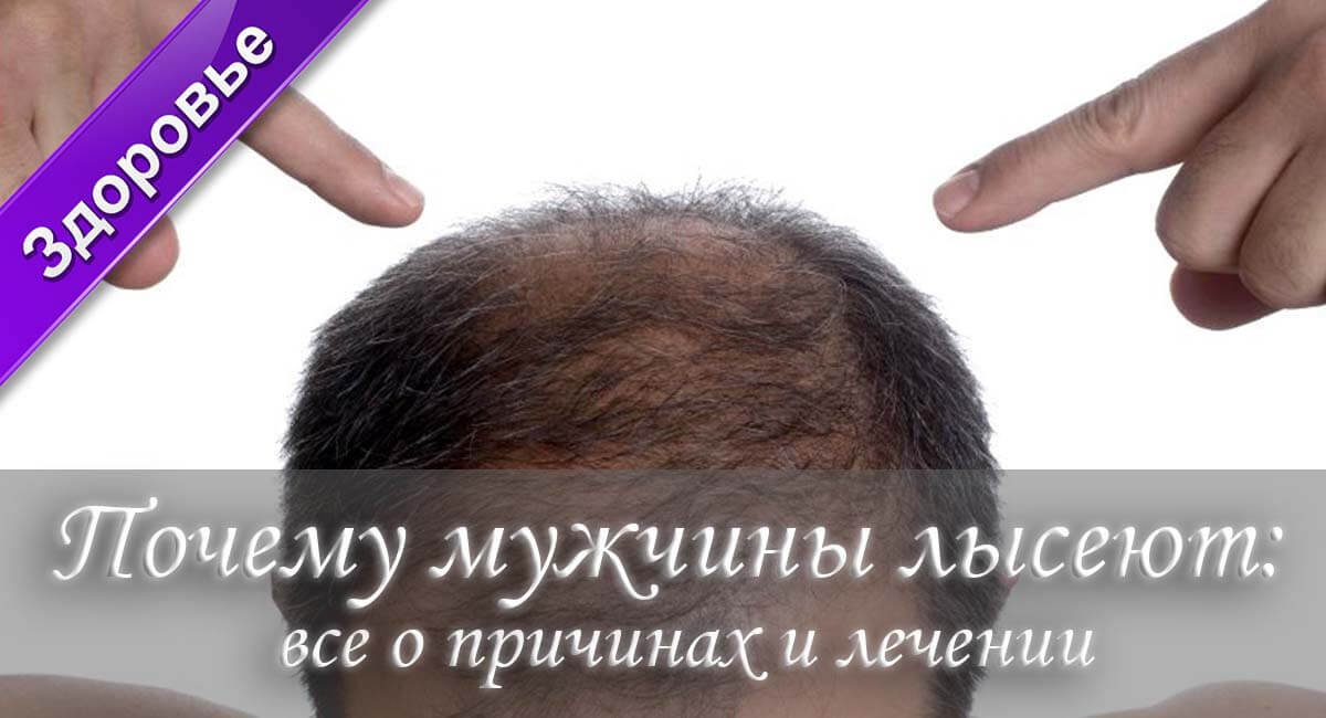 как перестать лысеть, я лысею что делать