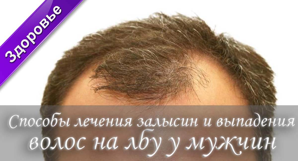 как перестать лысеть, я лысею что делать