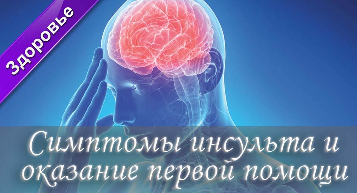 Как понять что инсульт, признаки инсульта