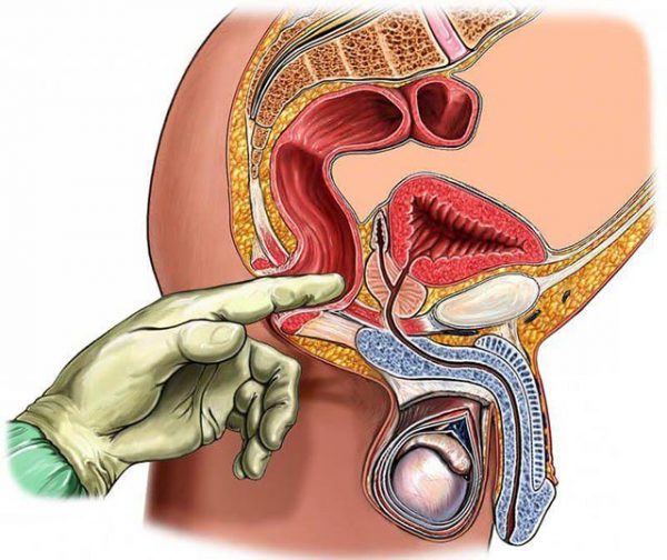 massaz prostatu