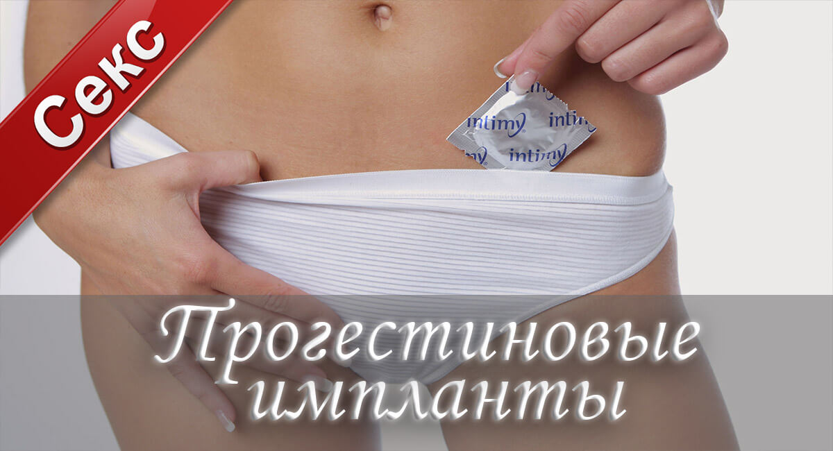 контрацепция, средства контрацепции, прогестиновый имплант, женщина, презерватив, секс